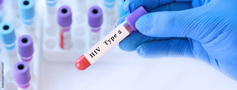 Fototapeta premium Doctor holding HIV type 2 blood test tube explaining detection of human immunodeficiency virus infection, immune status evaluation and differential diagnosis in clinical laboratory diagnostics