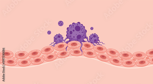 Microscopic illustration showing malignant cancer cells with tentacles invading healthy tissue and blood vessels for medical education and awareness.