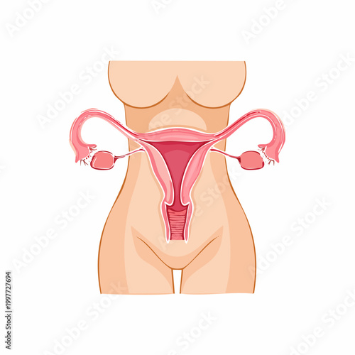 Medical illustration of the female reproductive system within a woman's torso.