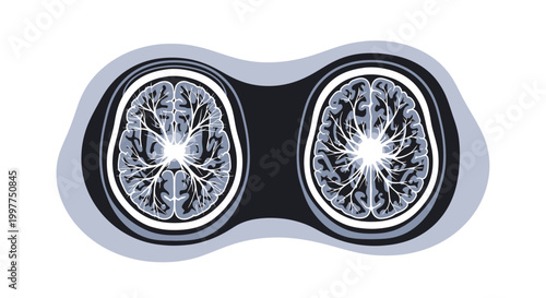 Dual human brain scans representing neurological activity and cognitive function. EPS Editable. Vector Illustrations.