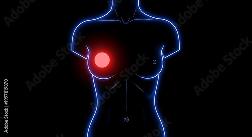 Neon outline of female torso with red spot on breast blue