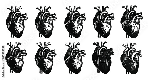 Detailed black anatomical heart vector illustration with a prominent electrocardiogram line on one