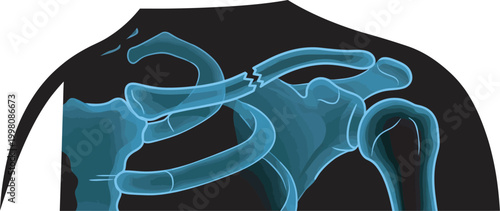 Clavicle and shoulder joint scan illustration for medical diagnosis