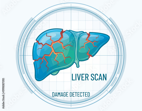 Liver scan illustration showing detected damage on organ