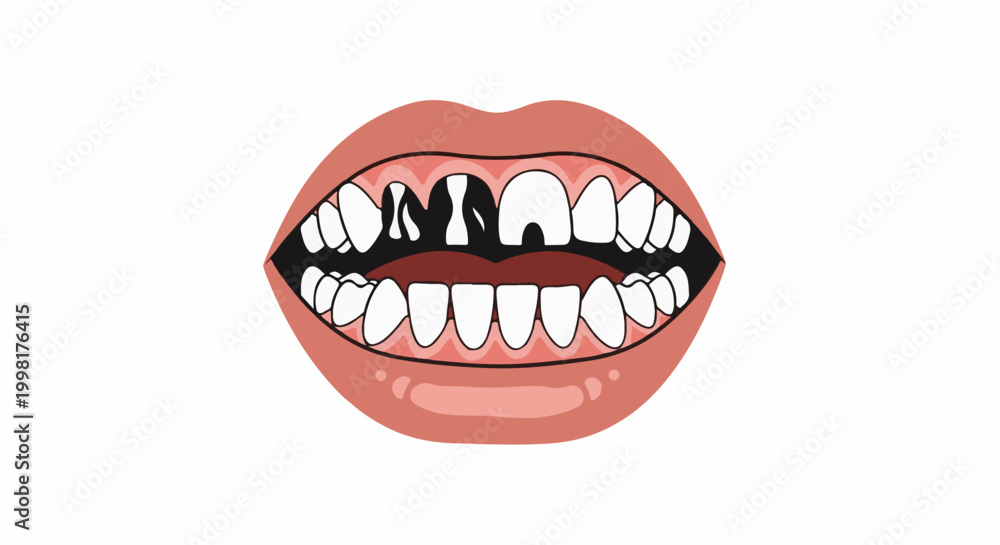Fototapeta premium Open mouth with cracked and missing teeth, white background