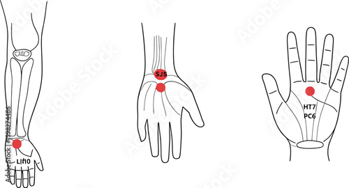 Acupuncture points on the human arm and hand diagrams
