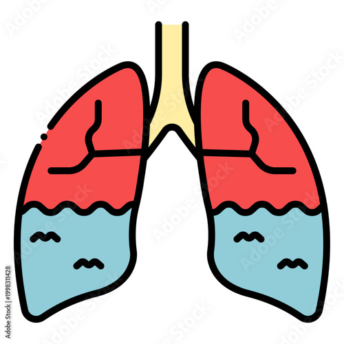 Lungs with Fluid: Pulmonary Edema Vector Illustration