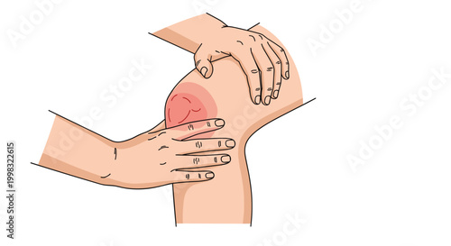 An educational color illustration depicts two hands applying pressure to a red inflamed knee joint signifying injury or pain against a plain white background.