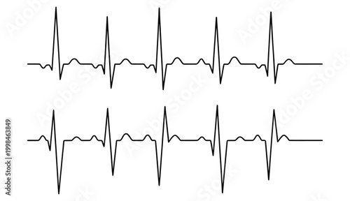 Ecg heart rate rhythm strips isolated on white background