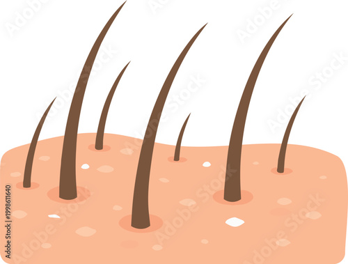 Illustration of human scalp with visible dandruff flakes and hair follicles.