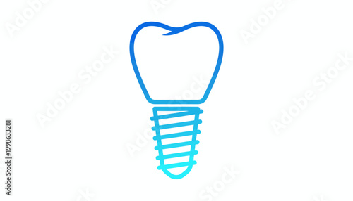 Dental implant, tooth implant icon, blue medical symbol, dental care illustration, vector graphics