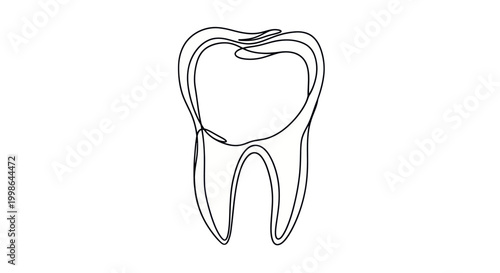Dental Molar Tooth Medical Illustration.
