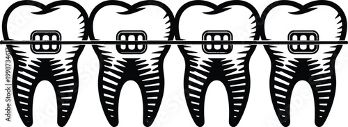 Black and white of four teeth with braces aligned in a row