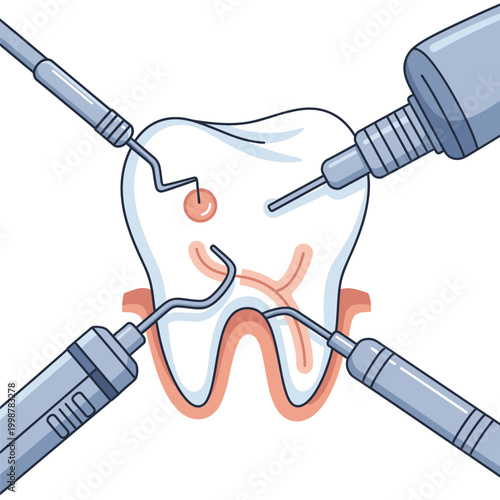 Dental illustration showing a tooth being examined by various dental tools.