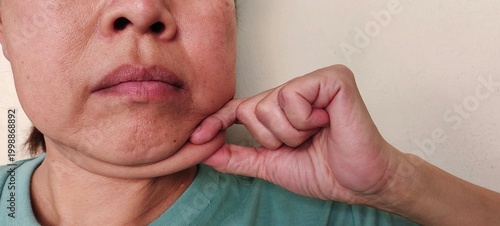 portrait the fingers holding the flabbiness adipose sagging skin under the chin, neck wattle and cellulite, large and layer skin of the woman, health care and beauty concept.