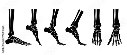 Human foot bone anatomy set, skeleton foot joints and tarsal bones in various positions and angles, medical vector illustration isolated on white background for orthopedics and podiatry educational st