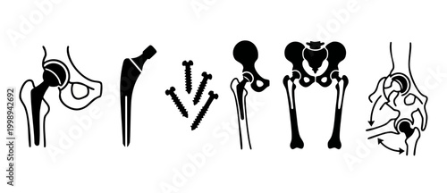 Hip replacement surgery implant icons, orthopedic joint procedure components, medical skeleton anatomy vector silhouettes for surgeon education, healthcare diagrams, prosthetic device, clinical bone r