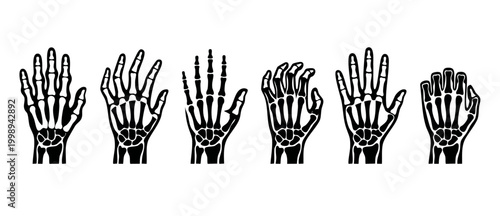 Human Hand Skeleton Bone Set, Medical Anatomy Vector Illustrations of Palm Gestures for Orthopedic Science, Biology Education, X-ray Style Graphics, Monochrome Isolated Elements on White Background