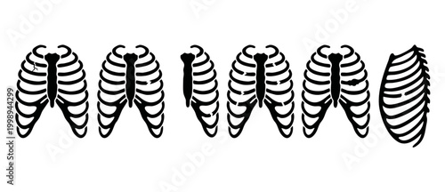 Human Rib Cage Anatomy Icons, Broken Ribs and Bone Fracture Set for Medical Illustration and Injury Diagnosis on White Background. Professional Vector Collection for Orthopedic and Clinical Use.