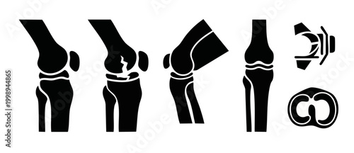 Human Knee Joint Anatomy Icons Set, Orthopedic Medical Infographic Elements Showing Healthy Joints, Fractures, Meniscus Damage and Patella Bone Structures for Clinical Health Education and Illustratio