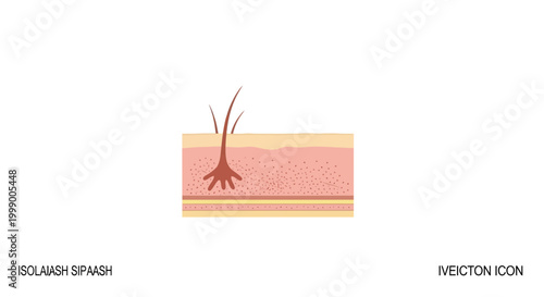 Flat vector illustration of a human arm with red skin rash symptoms indicating dermatitis allergy or contagious infection isolated on a white background for medical and healthcare design.