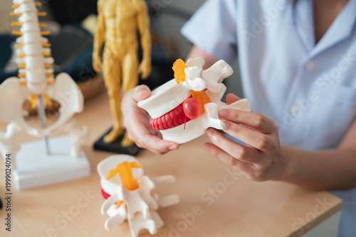 Fotografía Medical healthcare diagnosis doctor patient consultation spine model demonstrati