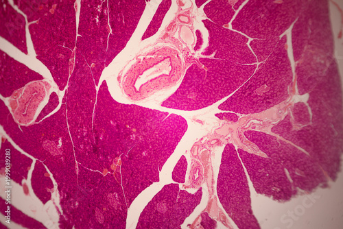 Fotografía Microscopic stained section of tissue showing dense areas of magenta cells, light branching areas, and circular structures