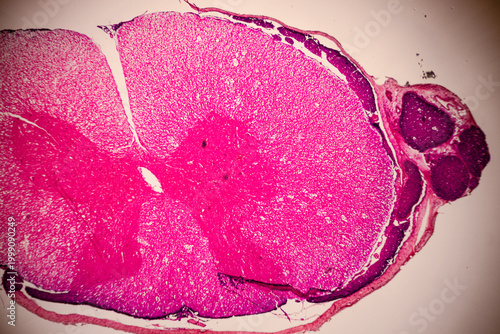 Obraz na plátně Microscopic stained section of tissue showing dense pink layered structures, pale cavities, and cellular textures