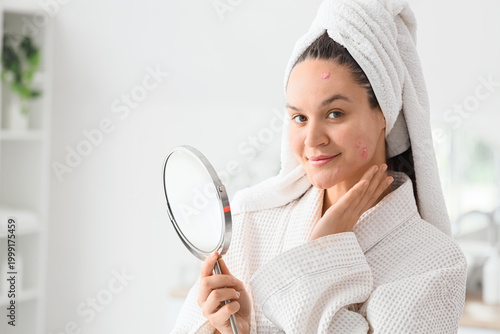 Photos Young woman with acne problem holding mirror in bathroom