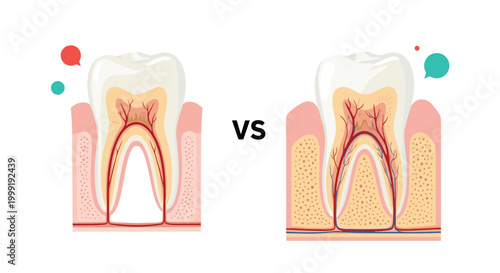Medical dental illustration comparing a healthy human tooth with an infected one showing decay and root canal issues.
