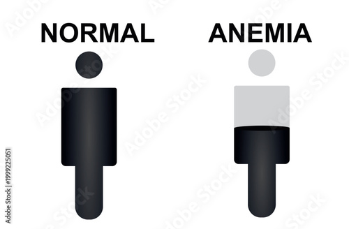 Normal and anemia icon. vector