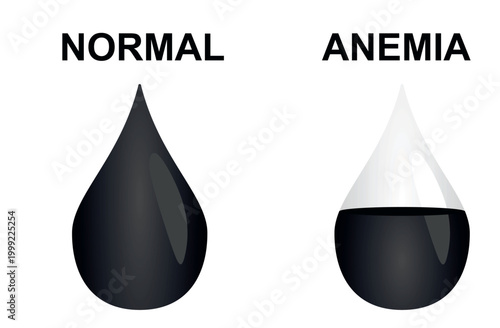 Normal and anemia icon. vector