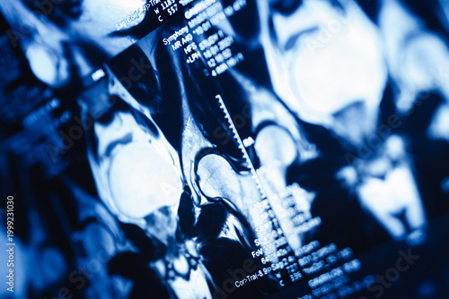 MRI scans show detailed views of knee joints in a medical setting during an examination process in a hospital