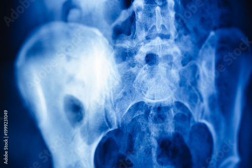X-ray shows pelvic area with bones and soft tissues clearly visible during examination