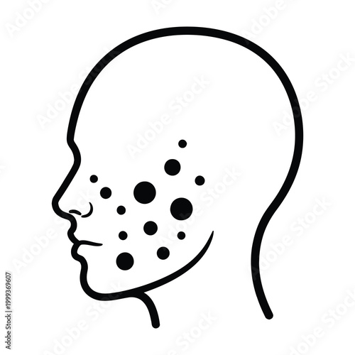 Acne skin problem black spots on face acne on cheek skin issue health concern