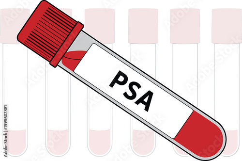PSA blood test vial isolated on white background