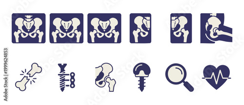 Pelvis X-ray Hip Replacement Orthopedic Icons Set Illustrating Bone Fracture, Surgical Plates, Medical Implants, and Healthcare Diagnostics for Clinical Reports and Orthopedic Surgeon Presentation Des