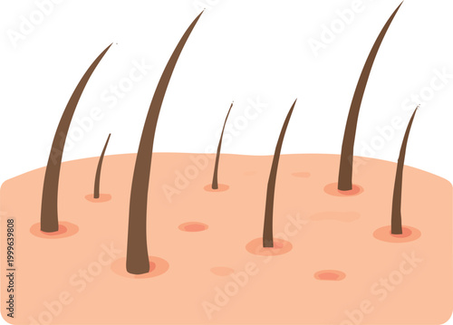 illustration of human scalp showing hair loss with reduced hair density and visible follicles. Suitable for dermatology, healthcare, and hair care concepts.