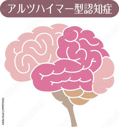 Alzheimer’s disease brain illustration flat