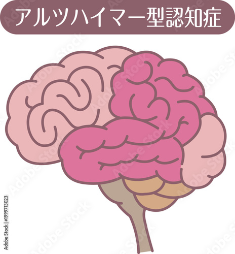 Alzheimer’s disease brain illustration line