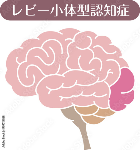 Lewy body dementia brain illustration flat