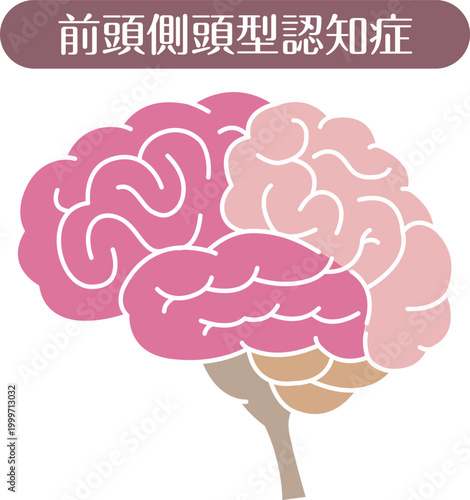 Frontotemporal dementia brain illustration flat