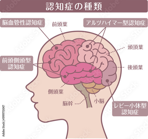Dementia types brain diagram side view line