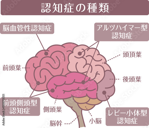 Types of dementia brain illustration line style