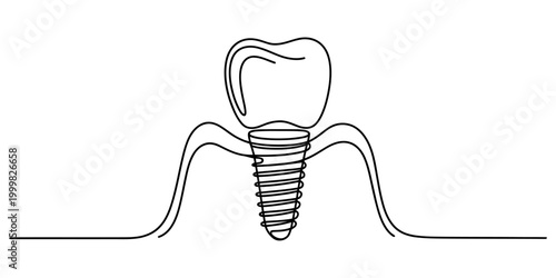 Continuous single line drawing of a dental implant with a tooth crown showing a medical concept for oral health care and professional dentistry services Vector, illustration