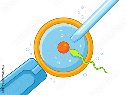 In Vitro Fertilization IVF Medical Illustration: ICSI Process with Sperm Cell and Egg Ovum for Reproductive Health and Fertility Science