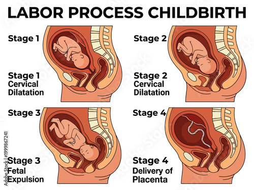 Labor Process Childbirth Stages Diagram: Cervical Dilatation, Fetal Expulsion, and Placenta Delivery Medical Illustration