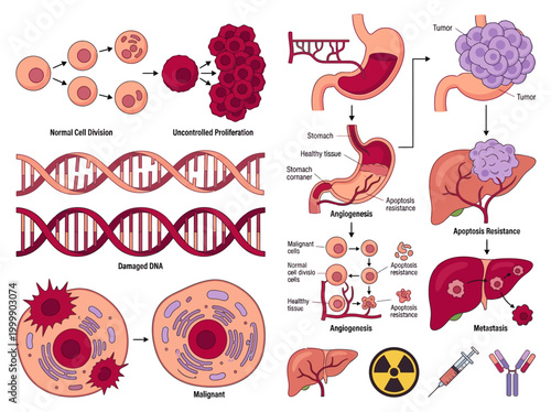Cancer Development and Progression Medical Diagram Illustrating Metastasis, DNA Damage, and Cell Proliferation