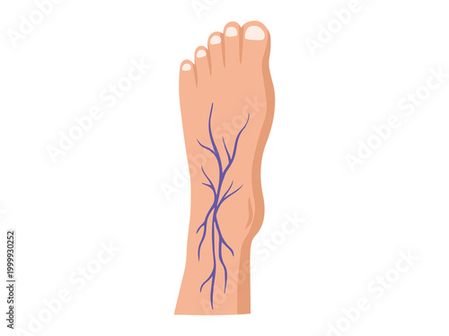 Hand Drawn Varices Foot Illustration
