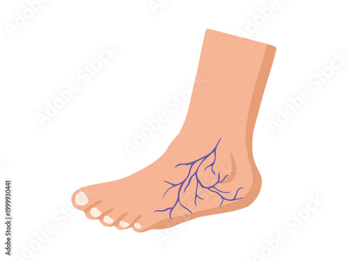 Hand Drawn Varices Foot Illustration
